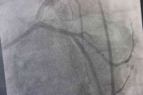 Dünyada Yilda 500 Bin Insanin Ölümü Trans Yaglardan