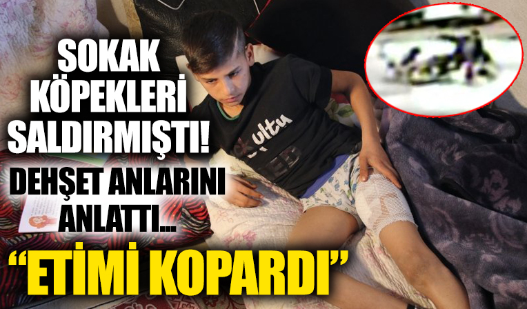 Ankara’da köpeklerin saldırdığı Ramazan Aslan konuştu: Çok canım yandı!
