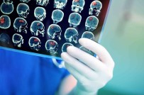 Yeni Cerrahi Teknolojiler Beyin Tümörü Ameliyatlarindaki Basariyi Artiriyor