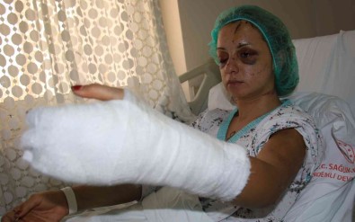 Yogun Bakimdan Çikan Kadin, O Anlari Anlatti