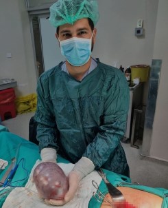 Yumurtalik Kanserine Yakalanan Hastadan 17 Santimetrelik Tümör Çikarildi