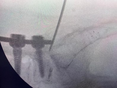 Türk Doktor, Buldugu Yöntemle Literatüre Girdi