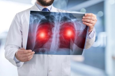 Sigara Içenlerde Risk 25 Kat Artiyor