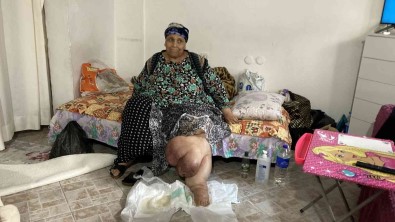 Bacaklari Sisip Iltihaplanan Kadin Tedavi Olmak Istiyor