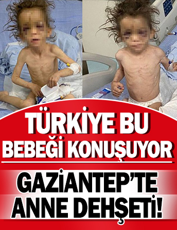 Türkiye Gaziantep’teki anne dehşetini konuşuyor: 5 yaşındaki çocuğunu günlerce aç bırakıp işkence yaptı!