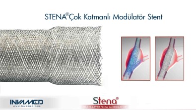 Aort Anevrizmasina STENA Stent Tedavisi