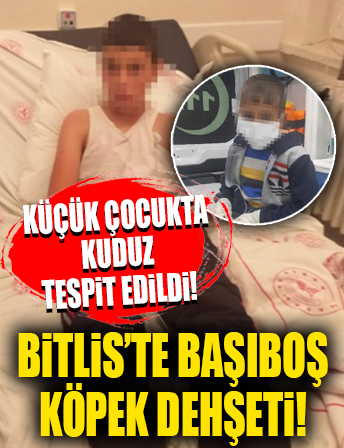 Bitlis'te köpeğin ısırdığı 2 çocuktan biri kuduz oldu! 'Sudan korkuyor, hırçın davranıyor'