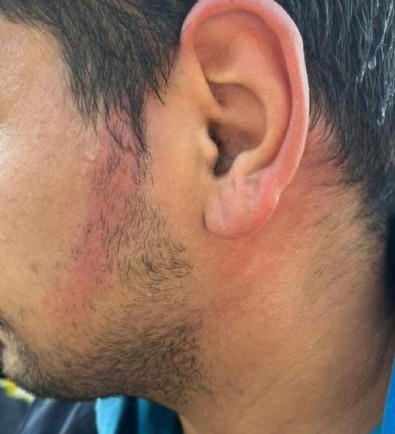 Ümraniye'de klima borusu patlayan İETT'de yolcu yaralandı