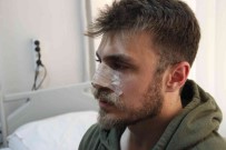 Izmir'de Darp Edilen Asistan Doktorun Burnu Kirildi