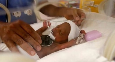 Dünya onları konuşuyor! Doğdukları an tarihe geçtiler: Tam manasıyla dokuz doğurdu...