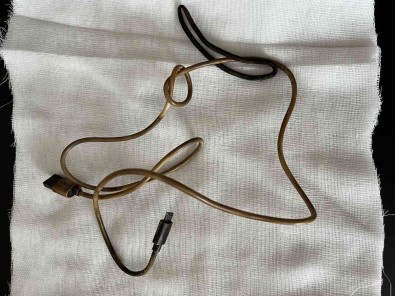 Kusma Ve Karin Agrisi Sikayetiyle Doktora Giden Çocugun Karnindan Telefon Sarj Kablosu Çikti