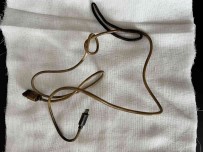 Kusma Ve Karin Agrisi Sikayetiyle Doktora Giden Çocugun Karnindan Telefon Sarj Kablosu Çikti