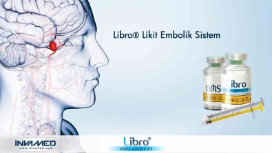 Her Yil Yaklasik 500 Bin Kisi Beyin Kanamasi Geçiriyor