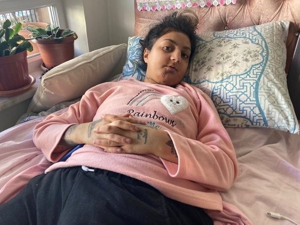 Ankara’da 4 ayda kabusu yaşadı! “Eski güzelliğimden eser kalmadı”.