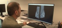 Mamografi Islemi Ile Ilgili Efsaneler Yeni Cihazlarla Son Buldu