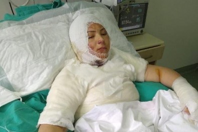 Eski eşi Elvan Sözkesen'i yanıcı maddeyle ateşe verip yanarken izledi!