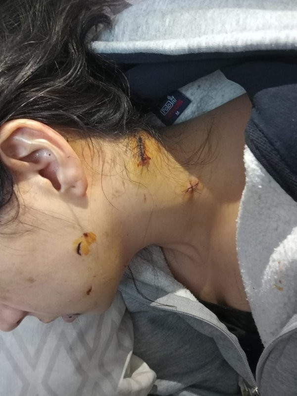 'Ağabey' demediler diye dehşeti yaşattı! Yeğenini dövüp yengesini 37 kez bıçakladı...