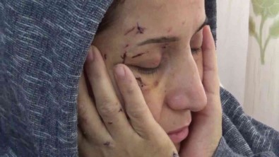 Yegeni Elini Öpmedi Diye Dövdü, Sonra Da Yengesini 50 Yerinden Biçakladi