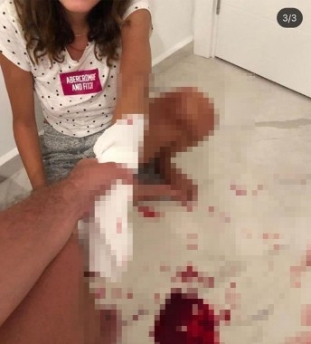 İşkence görüntüleri dehşete düşürmüştü! Fenomen İrem Ay'dan flaş paylaşım!