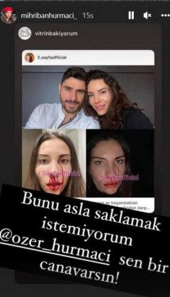 Özer Hurmacı'nın eşi Mihriban şiddete uğradığını açıklamıştı! Dehşet anlarını anlatı...