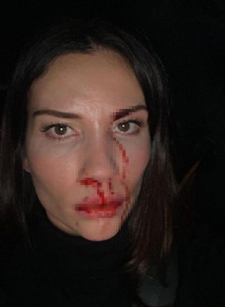 Özer Hurmacı'nın eşi Mihriban şiddete uğradığını açıklamıştı! Dehşet anlarını anlatı...