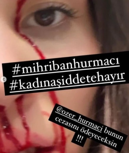 Özer Hurmacı'nın eşi Mihriban şiddete uğradığını açıklamıştı! Dehşet anlarını anlatı...