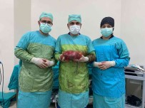 Karninda Sislik Olan Hastanin Büyüyerek 25 Santim Olan Böbregi Alindi