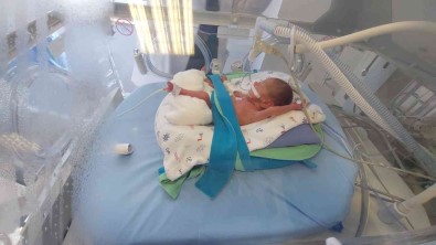 495 Gramlik Prematüre Bebege Kök Hücre Nakli Yapildi