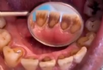 ABD - Nasıl olduğunu göstermek için korkunç gerçeği gözler önüne serdi!