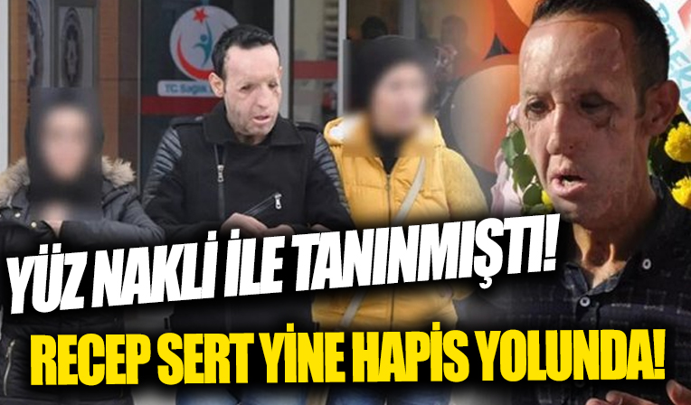 İlk yüz nakli yapılmıştı! Uyuşturucudan gözaltına alınan Recep Sert: Göreceksiniz