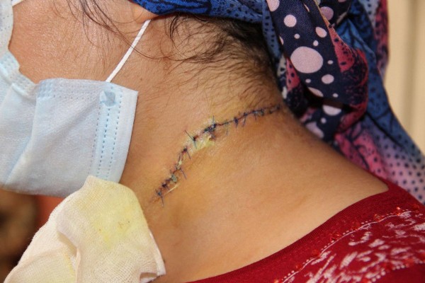 Eşinin boğazını kesen cani kocaya 'iyi hal indirimi' uygulandı!