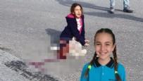 ANTALYA - Antalya'da korkunç olay: 9 yaşındaki kızın bacağı paramparça oldu! 'Isırsa daha iyiydi'