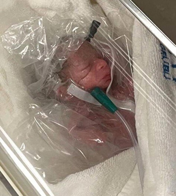 114 gün sonra gelen mutluluk: 600 gram doğdu hayata tutundu!