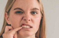 Diş Fırçalarken Kanama Neden Olur? Diş Eti Kanamaları Nasıl Geçer? Haberi