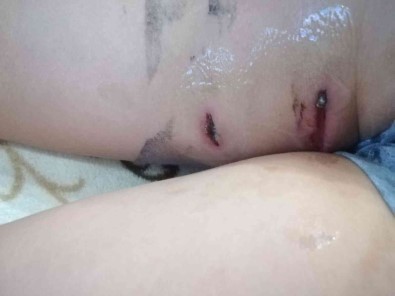 Basibos Köpeklerin Saldirisindan Ölü Taklidi Yaparak Kurtuldu