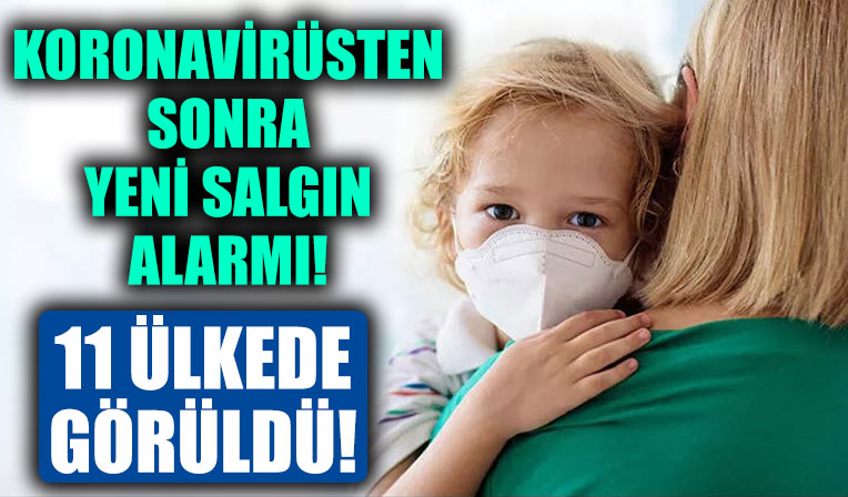 Koronavirüsten sonra yeni salgın! 11 ülkede görüldü, DSÖ açıklama yaptı!