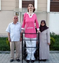 RUMEYSA GELGİ - 'Dünyanın en uzun kadını' Rumeysa Gelgi’den 3 rekor daha!