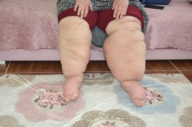 15 Yildir Hastaligina Teshis Konulmayan Kadinin Hayati Kabusa Döndü