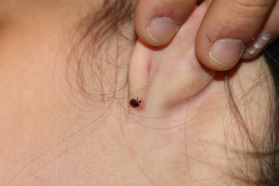 Kulagina Kene Yapisan Küçük Çocuk Hastaneye Kaldirildi