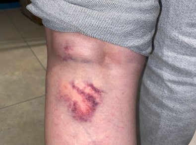 29 Yasindaki Hasret, Sokakta Dehseti Yasadi