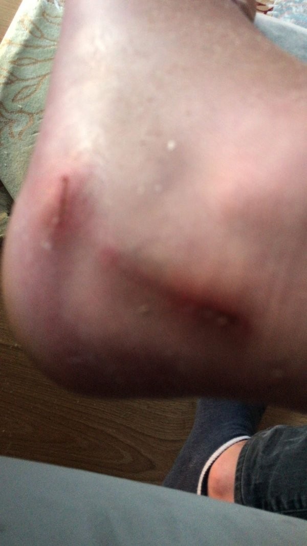 Pendik'te korkunç olay! Alçı çıkarmaya gitti, ayak ve bacağı kesildi!