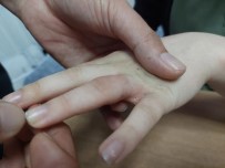 15 Yasindaki Gencin Parmagina Sikisan Yüzügü AFAD Ve Saglik Ekipleri Çikardi