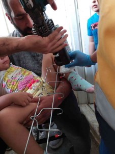 Oyun Oynarken Bacagina Demir Askiligin Kancasi Saplandi