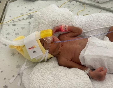 850 Gramlik Birsen Asel Bebek, 100 Günde Yasama Tutundu