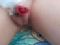 Yanlis Sünnet Edilen Çocugun Hayati Karardi Açiklamasi '21 Gündür Su Içmeye Korkuyor'