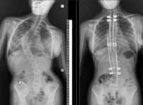 500 Bin Liralik Ameliyati 1 Kurus Vermeden Oldu