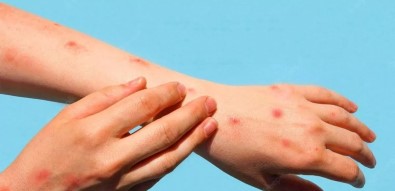 'Domates Gribinin Kontrol Altina Alinmasi Zor Görünüyor'