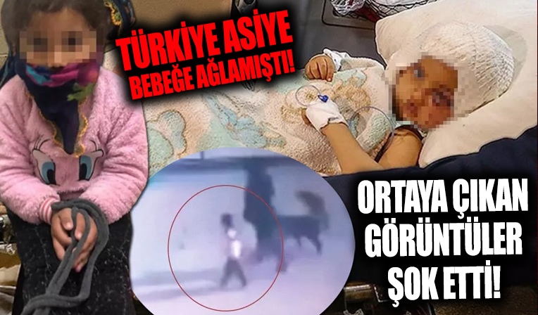 Asiye bebeğe annesi tasma takıp ellerini bağlamış! Pitbull saldırısına uğradığı anlar Türkiye'yi kahretmişti