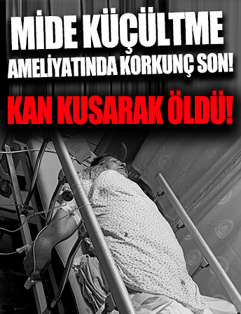 Mide küçültme ameliyatında korkunç son! Kan kusarak öldü