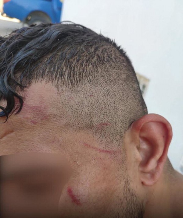 Yunan zulmünün en net örneği: Copla dövüp ölüme ittiler!